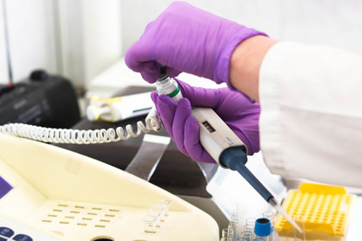 宜宾DNA亲子鉴定