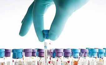 亲子鉴定应具备的条件